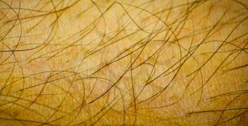 Dermatology. Macro image of Hairy Human Skin With Wrinkles depicting aging process.