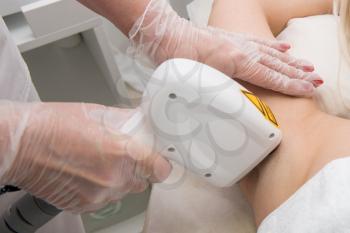 Laser epilation of armpits, hair removal cosmetology procedure. Health and beauty concept.