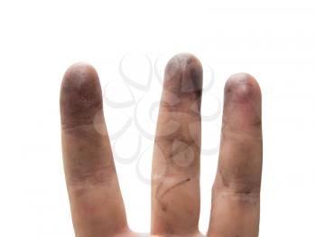 dirty finger on a white background
