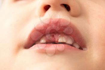 The mouth of a boy without a tooth .