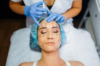Cosmetician makes botox injection in dotted lines on female patient face, botox injections preparation. Rejuvenation procedure in beautician salon. Cosmetic surgery against wrinkles and aging