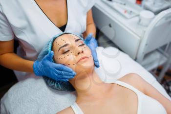 Cosmetician makes botox injection in dotted lines on female patient face, botox injections preparation. Rejuvenation procedure in beautician salon. Cosmetic surgery against wrinkles and aging