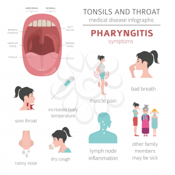 Tonsils and throat diseases. Pharyngitis symptoms, treatment icon set. Medical infographic design. Vector illustration