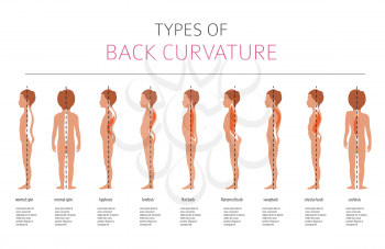 Types of back curvature. Medical desease infographic. Vector illustration