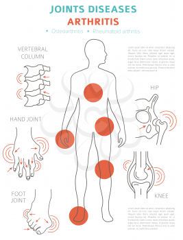 Joints diseases. Arthritis symptoms, treatment icon set. Medical infographic design.  Vector illustration