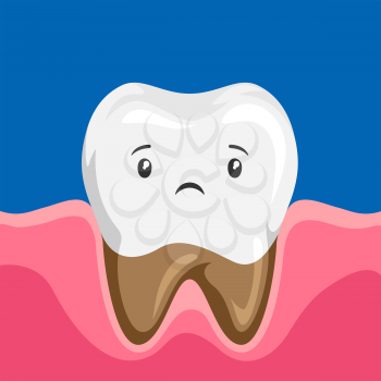 Illustration of sick tooth with caries. Children dentistry sad character. Kawaii facial expression.