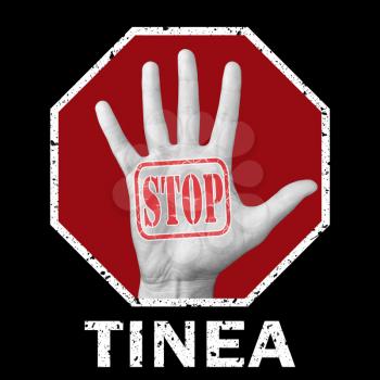 Stop tinea conceptual illustration. Open hand with the text stop tinea