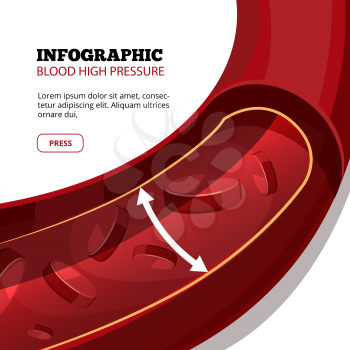 Blood high pressure vector medical infographic. Cardiovascular and bloodstream illustration