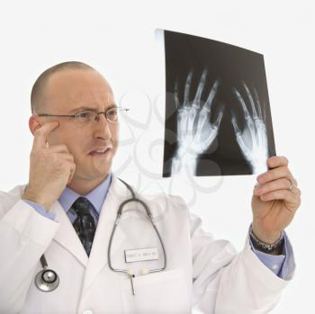 Royalty Free Photo of a Male Physician Holding Up Hand X-Rays Looking Perplexed