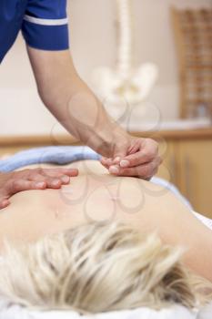 Royalty Free Photo of Acupuncture