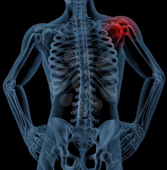 3D render of a medical skeleton with the shoulder joint highlighted