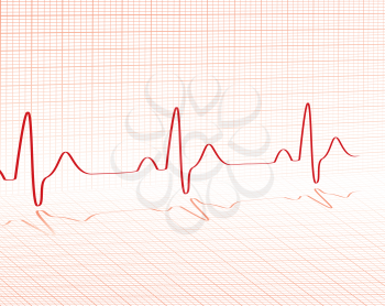 Royalty Free Clipart Image of a Heartbeat Grid