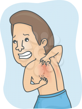 Illustration of a Man Desperately Scratching the Rashes on His Back