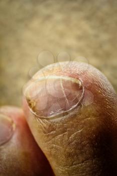 Toe nail macro with some cracks and damages needs some grooming. No pedicure nail.