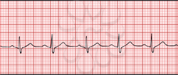 Normal electronic cardiogram vector illustration

