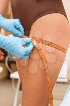 woman before procedures, doctor measuring her thigh