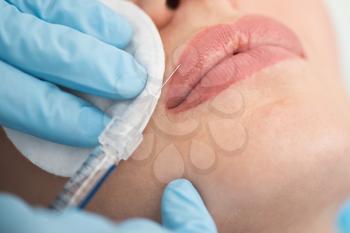 Closeup of woman gets injection in her lips