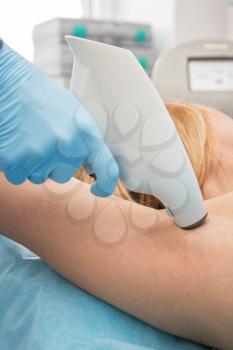 Procedure for armpit against hyperhidrosis