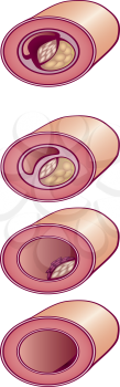 Royalty Free Clipart Image of Cross Sections of a Vein With Cholesterol