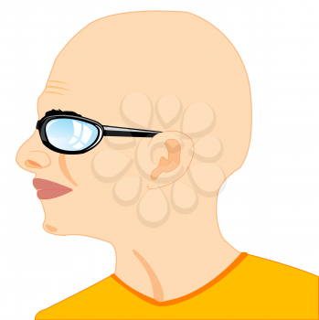 Vector illustration of the bald young person on white background