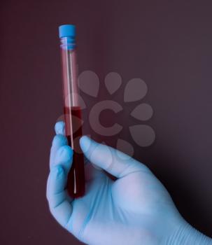 A doctor in blue disposable latex gloves is holding a test tube with a blood sample.