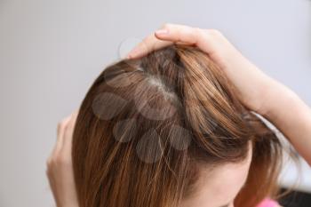 Woman with hair loss problem at home, closeup�