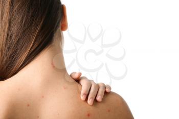 Girl with acne problem on white background�