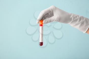 Doctor's hand holding test tube with blood sample on color background�