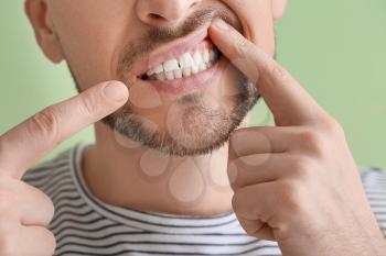 Man suffering from tooth ache on color background, closeup�