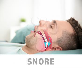 Illustration showing airway during snore�