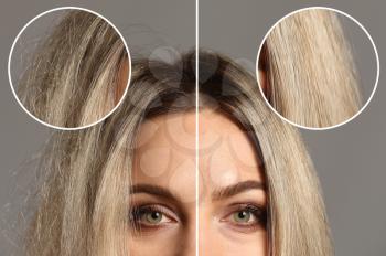 Woman before and after hair treatment on grey background�