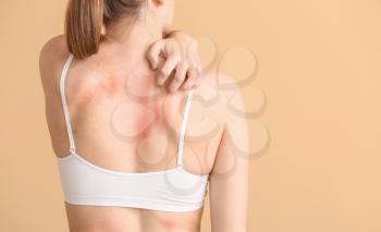 Young allergic woman scratching her skin against color background�