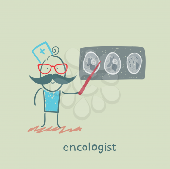 oncologist ?????????? ????????????? ???????????