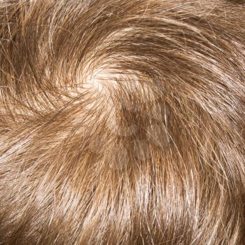 pattern of hair