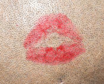 lipstick kiss on the scalp