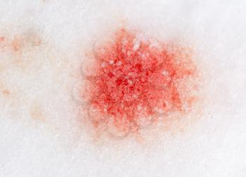 red blood on the snow