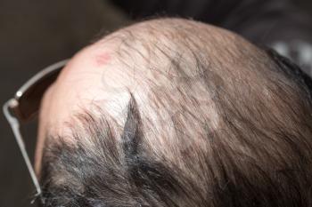 Bald head on a man's head as a background .