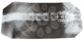X-ray picture of human spinal column isolated on white background
