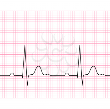 Illustration of medical electrocardiogram - ECG on chart paper, graph of heart rhythm, 2d illustration, vector, eps 8