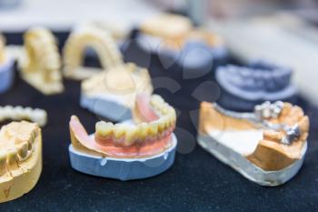 Denture treatment, dental implants closeup, medicine equipment. Dentist cabinet, stomatology. Tooth care mouth hygiene