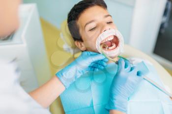 Little boy with open mouth in a dental cabinet, caries removal procedure, pediatric dentistry. Female dentist looking for caries