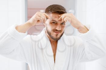 Man in bathrobe cauterizes pimple in bathroom, routine morning hygiene. Male person at the sink performs skin and body treatment procedures