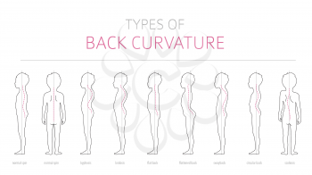 Types of kid`s back curvature. Medical disease infographic. Outline version. Vector illustration