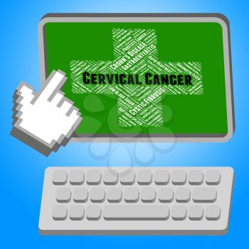 Cervical Cancer Meaning Malignant Growth And Ailments