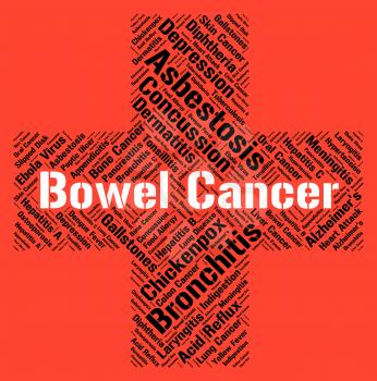 Bowel Cancer Representing Cancerous Growth And Guts