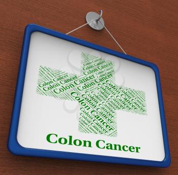 Colon Cancer Showing Large Intestine And Disease