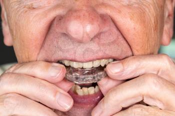 Senior caucasian man putting plastic mouth or night guard onto crooked stained teeth