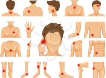 Body pain. Physical injury human trauma symbols on legs shoulders hands pain dots vector set. Pain leg, elbow or shoulder and knee illustration