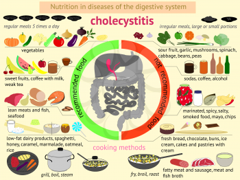 infographics proper nutrition in diseases of the digestive system. Cholecystitis. EPS 10