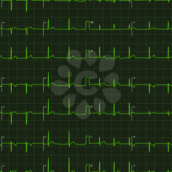 Typical human electrocardiogram green graph with white marks on dark background, seamless pattern